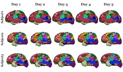 A study of 23 healthy volunteers scanned five times over six months revealed high intrasubject reproducibility and demonstrated that the parcellating algorithm could detect intersubject variation.