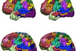 2016 01 13 16 19 16 810 2016 01 14 F Mri2 20160113232555