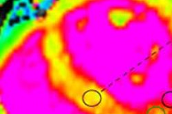 2016 01 29 10 43 27 464 2016 02 01 Galea Mapping Mi T1 20160129174417