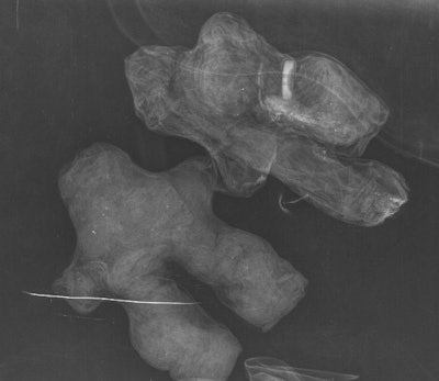 Two dolls made of black fabric. All images courtesy of Dr. Philippe Charlier, PhD.