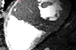 2016 02 12 12 01 43 834 2016 02 15 7 T Cardiac Mri 20160212190534