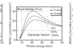 2016 02 17 13 04 50 464 2016 02 18 Medphysweb Mettivier Fig7 8 350
