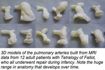 2016 02 22 13 22 55 39 2016 02 23 3 D Printing Sefalian