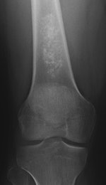 Incidental findings
