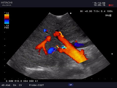Above: Image of the liver using the Hitachi Precision system. Below: Image of adult heart using the Hitachi Prologue ultrasound system.