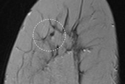 2016 03 02 19 02 44 811 2016 03 03 Ecr Today Breast Errors Image Thumb