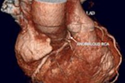 2016 03 03 17 35 43 143 2016 03 04 Ecr Today Cardiothoracic1 3 20160304003958