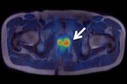 2016 03 04 16 05 50 296 2016 03 05 Ecr Today Pet Mri Thumb