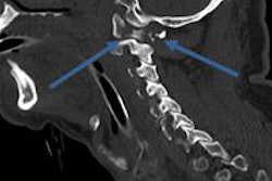2016 03 04 17 04 16 235 2016 03 05 Ct Trauma1 20160305000830