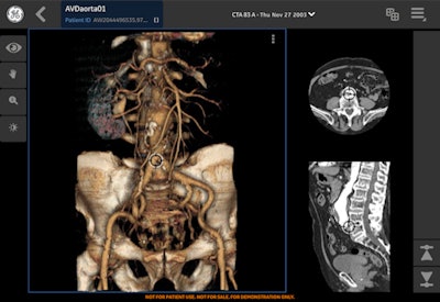 The Centricity Cloud Advanced Visualization radiology app is being promoted by GE Healthcare at ECR 2016.