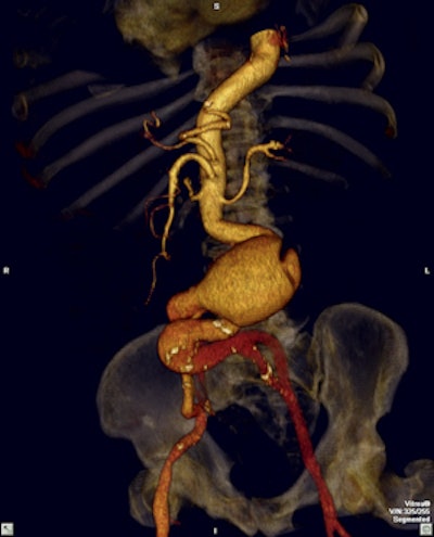 Leading hospitals in Colombia make use of the latest software to visualize and analyze 2D, 3D, and 4D images. All images courtesy of the Asociación Colombiana de Radiología.