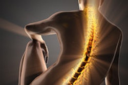 2016 03 14 11 36 38 451 X Ray Spine Back 200