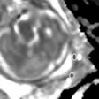2016 03 14 16 41 06 215 Adc Masselli 200