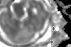 2016 03 14 16 41 06 215 Adc Masselli 200