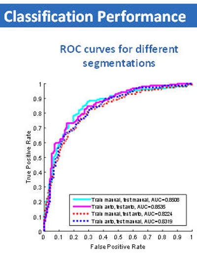 Classification performance graph (above) and chart (below) shows no significant difference in assessment of nodule malignancy risk by manual or semiautomated (Otsu) methods.