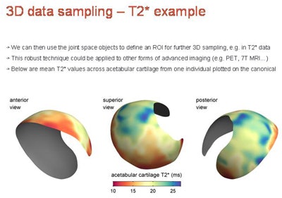 3D data sampling example from T2-weighted MRI represents a mean T2* map from seven cadavers, 3-mm slice separation, potentially capable of sampling and representing any modality/parameter with appropriate focus and development.