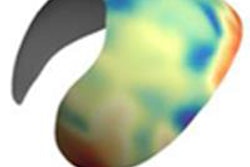 2016 03 25 12 17 28 96 2016 03 3 D Data Sampling Turmezei 20160325192332