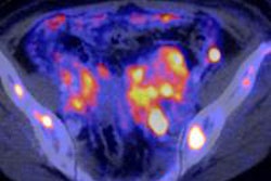 2016 04 01 08 30 40 973 2016 03 29 Pet Ct Pet Image 20160401153333