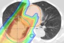 2016 03 31 11 35 28 808 2016 04 01 Medphysweb Ir Virt Ct 20160331183651