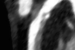 2016 04 20 11 46 29 982 2016 04 19 14 20 06 112 2016 04 15 Culprit Fuller 400 20160420184639