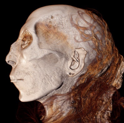 This 3D CT image of the profile of Thuya, great grandmother of Tutankhamun, depicts her facial features, even the two openings in her ear lobe for ear rings, in vogue at the time.