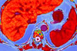 2016 04 28 11 19 06 773 2016 04 29 Perspectum Liver Multi Scan Lif3 3 20160428181922