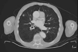 2016 05 09 12 21 58 747 2016 05 10 Drk3 Ct Polytrauma Abb 3 Nebenbefunde Der Kategorie 1 20160509204023