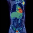 2016 05 11 09 07 32 907 2016 05 11 Pet Ct Thumb