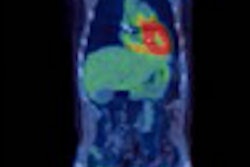 2016 05 11 09 07 32 907 2016 05 11 Pet Ct Thumb