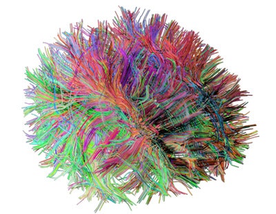 Holoxica's 3D digital hologram of human brain fiber pathways.