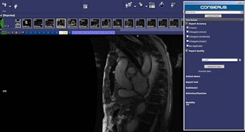 2016 05 27 11 47 30 566 2016 05 30 Mckesson Conserus Wi Peer Review 350