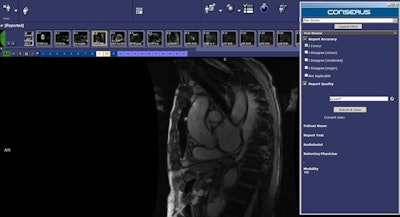 2016 05 27 11 47 30 71 2016 05 30 Mckesson Conserus Wi Peer Review 800