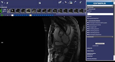 2016 05 27 11 47 32 51 2016 05 30 Mckesson Conserus Wi Critical Results 350
