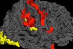 2016 05 27 15 38 28 160 Schizophrenia 450 20160527224045