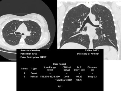 This reconstructed noncontrast CT image of the chest (lungs) was also achieved with reduced tube voltage of 80 kVp and automatic tube current modulation.