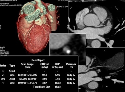 Low-dose CT for complex scanning is increasingly feasible, thanks to decreased tube voltage and current, in combination with iterative reconstruction, according to Sinitsyn. This reconstructed image from low-dose coronary CTA was achieved with reduced tube voltage of 80 kVp and automatic tube current modulation.