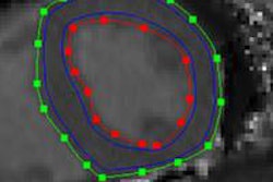 2016 06 20 11 53 19 721 2016 06 21 Plosone T1 20160620185451