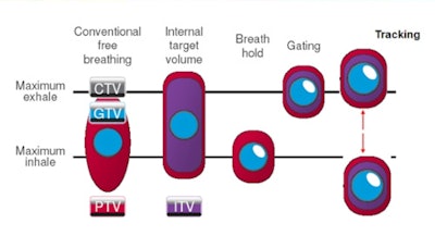 Breathing motion can be addressed using approaches such as margins, breath-hold, gating, and tracking.