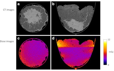 Dose distributions are largely homogeneous, shown here for transverse and coronal views of the mastectomy specimen. All images courtesy of European Radiology.