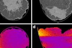 2016 07 06 15 13 58 569 2016 07 07 Breast Ct Pic1 20160706221840