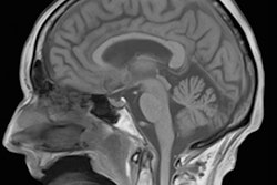 2016 07 08 11 17 27 44 2016 07 11 F Mri Gobrain