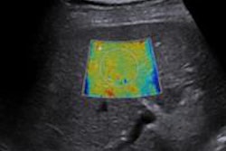 2016 07 11 12 17 50 886 2016 07 12 Ultrasound Pic2 20160711191806