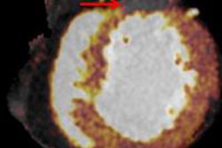 2016 07 20 11 57 28 921 2016 07 21 Henzler Ct Mpi Bottom 20160720190149