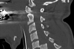 2016 08 08 14 54 02 809 2016 08 08 Cervical Spine