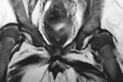 2016 08 09 11 53 01 230 2016 08 10 Zika Thumb