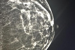 2016 08 11 14 35 18 449 2016 08 12 Malta Pic2 20160811215722