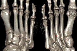 2016 08 18 15 27 32 209 2016 08 19 Gout Pic1 20160818223141