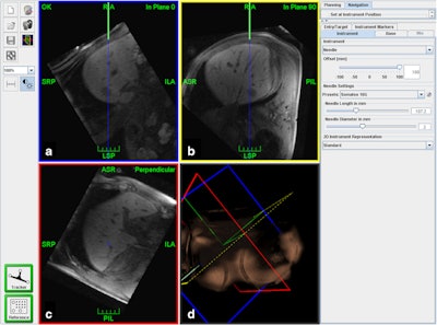 2016 08 22 09 02 16 570 2016 08 22 Er Moche Liver Fig3 800