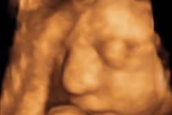 2016 08 22 16 21 11 182 Zika Fig 18 20160822232137