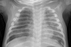 2016 09 01 14 27 55 227 2016 09 01 Pediatric Xray 20160901212856